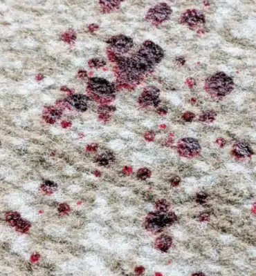 how to treat blood stains on carpet